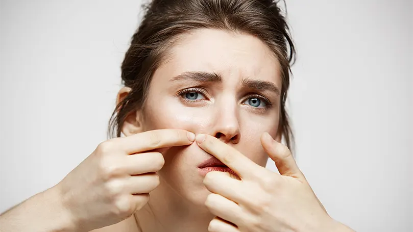 Een afbeelding van een jonge brunette met huidproblemen.